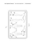 AUTOMATIC CURRENT BALANCING WITH LOCK CONTROL FOR A CLINICIAN PROGRAMMER diagram and image