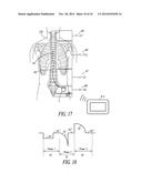 ARBITRARY WAVEFORM GENERATOR & NEURAL STIMULATION APPLICATION diagram and image