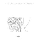 METHODS AND DEVICES FOR NON-INVASIVE CEREBRAL AND SYSTEMIC COOLING diagram and image