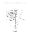 METHODS AND DEVICES FOR NON-INVASIVE CEREBRAL AND SYSTEMIC COOLING diagram and image