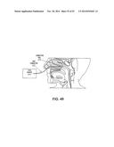 METHODS AND DEVICES FOR NON-INVASIVE CEREBRAL AND SYSTEMIC COOLING diagram and image