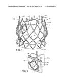 PROSTHETIC HEART VALVE DELIVERY APPARATUS diagram and image