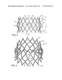 PROSTHETIC HEART VALVE DELIVERY APPARATUS diagram and image