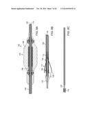 PROSTHETIC HEART VALVE DELIVERY APPARATUS diagram and image