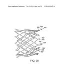 PROSTHETIC HEART VALVE DELIVERY APPARATUS diagram and image