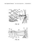 PROSTHETIC HEART VALVE DELIVERY APPARATUS diagram and image