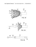 PROSTHETIC HEART VALVE DELIVERY APPARATUS diagram and image