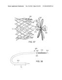 PROSTHETIC HEART VALVE DELIVERY APPARATUS diagram and image