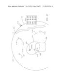 Flight Assistant with Automatic Configuration and Landing Site Selection diagram and image