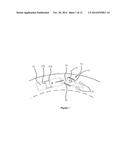 Method of and Apparatus for Braking a Tractor-Trailer Combination diagram and image