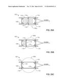 METHOD OF INSTALLING PACKING IN A REMOTE MANUFACTURING YARD diagram and image