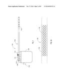 TERMINATION OF A SHIELD WITHIN AN IMPLANTABLE MEDICAL LEAD diagram and image