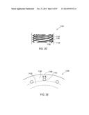 TERMINATION OF A SHIELD WITHIN AN IMPLANTABLE MEDICAL LEAD diagram and image