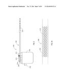 TERMINATION OF A SHIELD WITHIN AN IMPLANTABLE MEDICAL LEAD diagram and image