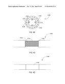 TERMINATION OF A SHIELD WITHIN AN IMPLANTABLE MEDICAL LEAD diagram and image