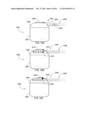 TERMINATION OF A SHIELD WITHIN AN IMPLANTABLE MEDICAL LEAD diagram and image