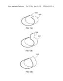 TERMINATION OF A SHIELD WITHIN AN IMPLANTABLE MEDICAL LEAD diagram and image