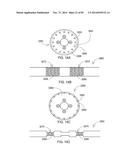 TERMINATION OF A SHIELD WITHIN AN IMPLANTABLE MEDICAL LEAD diagram and image