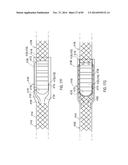 TERMINATION OF A SHIELD WITHIN AN IMPLANTABLE MEDICAL LEAD diagram and image