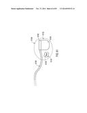 TERMINATION OF A SHIELD WITHIN AN IMPLANTABLE MEDICAL LEAD diagram and image