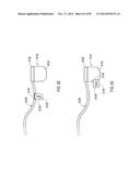 TERMINATION OF A SHIELD WITHIN AN IMPLANTABLE MEDICAL LEAD diagram and image