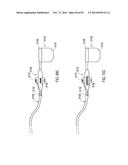 TERMINATION OF A SHIELD WITHIN AN IMPLANTABLE MEDICAL LEAD diagram and image