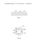 TERMINATION OF A SHIELD WITHIN AN IMPLANTABLE MEDICAL LEAD diagram and image