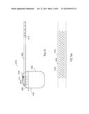 TERMINATION OF A SHIELD WITHIN AN IMPLANTABLE MEDICAL LEAD diagram and image