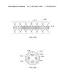 TERMINATION OF A SHIELD WITHIN AN IMPLANTABLE MEDICAL LEAD diagram and image