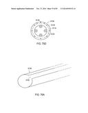 TERMINATION OF A SHIELD WITHIN AN IMPLANTABLE MEDICAL LEAD diagram and image