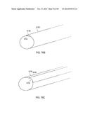 TERMINATION OF A SHIELD WITHIN AN IMPLANTABLE MEDICAL LEAD diagram and image