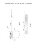 TERMINATION OF A SHIELD WITHIN AN IMPLANTABLE MEDICAL LEAD diagram and image