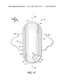 METHOD OF FORMING A CONTAINMENT SYSTEM FOR AN ABSORBENT ARTICLE diagram and image