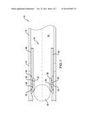 SELECTIVELY DEGRADABLE PASSAGE RESTRICTION diagram and image