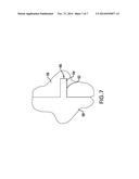 SELECTIVELY DEGRADABLE PASSAGE RESTRICTION diagram and image