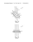 LASER BRAZE CERAMIC TO AN IMPLANTABLE MEDICAL DEVICE HOUSING diagram and image