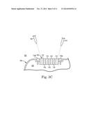 LASER BRAZE CERAMIC TO AN IMPLANTABLE MEDICAL DEVICE HOUSING diagram and image