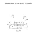 LASER BRAZE CERAMIC TO AN IMPLANTABLE MEDICAL DEVICE HOUSING diagram and image