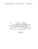 LASER BRAZE CERAMIC TO AN IMPLANTABLE MEDICAL DEVICE HOUSING diagram and image