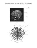 SYSTEMS AND METHODS FOR REDUCING MAGNETIC RESONANCE (MR) IMAGING ACOUSTIC     NOISE IN MR INFLOW IMAGING diagram and image