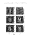 APPARATUS AND METHOD FOR QUANTITIVE PHASE TOMOGRAPHY THROUGH LINEAR     SCANNING WITH COHERENT AND NON-COHERENT DETECTION diagram and image