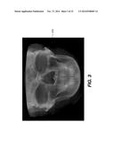 METHOD AND SYSTEM FOR USER INTERACTION IN 3-D CEPHALOMETRIC ANALYSIS diagram and image