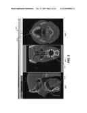 METHOD AND SYSTEM FOR USER INTERACTION IN 3-D CEPHALOMETRIC ANALYSIS diagram and image