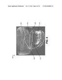 METHOD AND SYSTEM FOR USER INTERACTION IN 3-D CEPHALOMETRIC ANALYSIS diagram and image