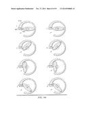 SEALING SYSTEM FOR GEROTOR APPARATUS diagram and image