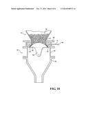 Solids Processing Valve diagram and image