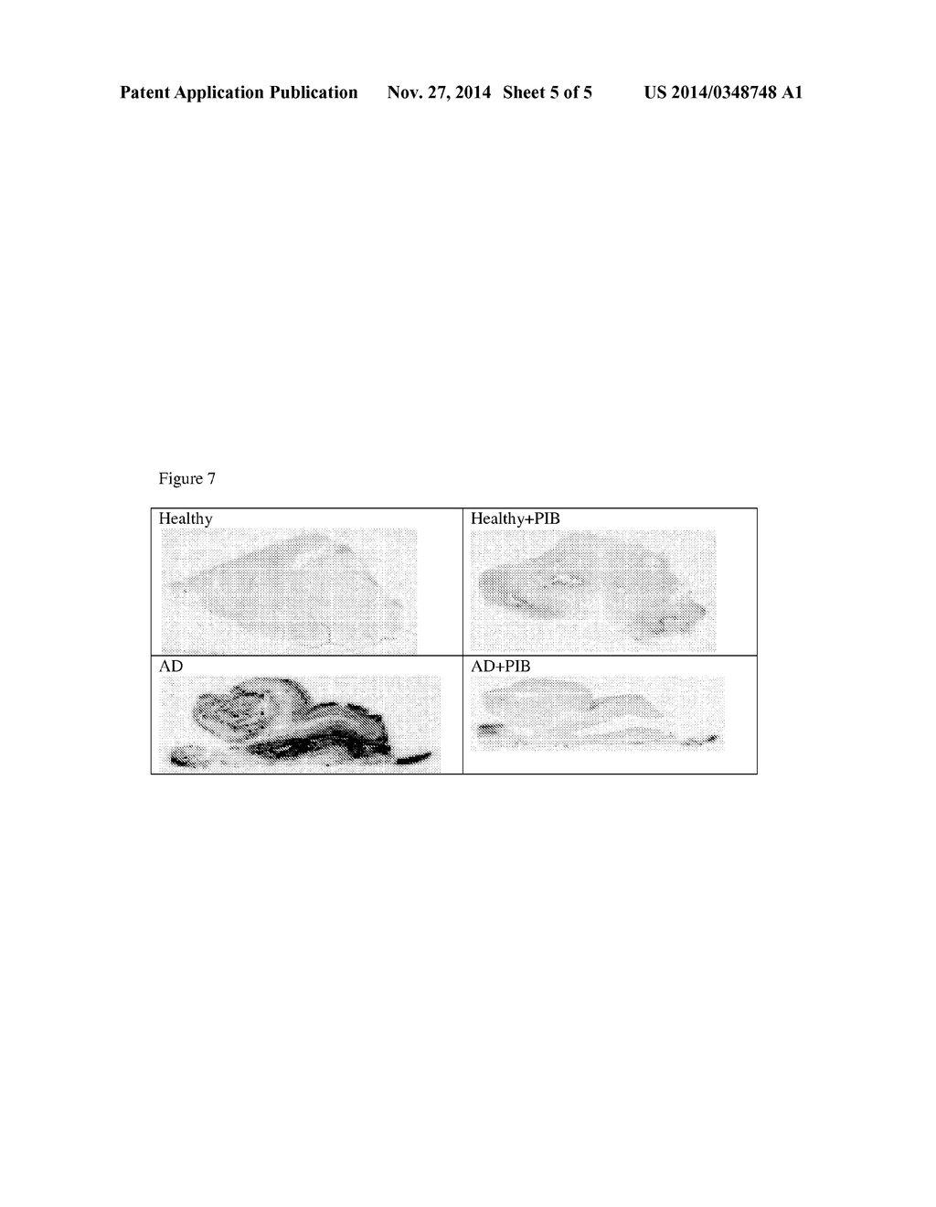 BETA-AMYLOID IMAGING AGENTS, METHODS OF MANUFACTURE, AND METHODS OF USE     THEREOF - diagram, schematic, and image 06