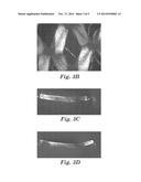 RETICULATED THERMOPLASTIC FILM AND METHOD OF MAKING THE SAME diagram and image