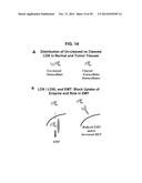 METHODS AND COMPOSITIONS FOR TREATMENT AND DIAGNOSIS OF FIBROSIS, TUMOR     INVASION, ANGIOGENESIS, AND METASTASIS diagram and image