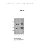 METHODS AND COMPOSITIONS FOR TREATMENT AND DIAGNOSIS OF FIBROSIS, TUMOR     INVASION, ANGIOGENESIS, AND METASTASIS diagram and image